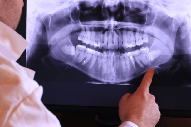 Best Dental Abscess Treatment in Omao, HI